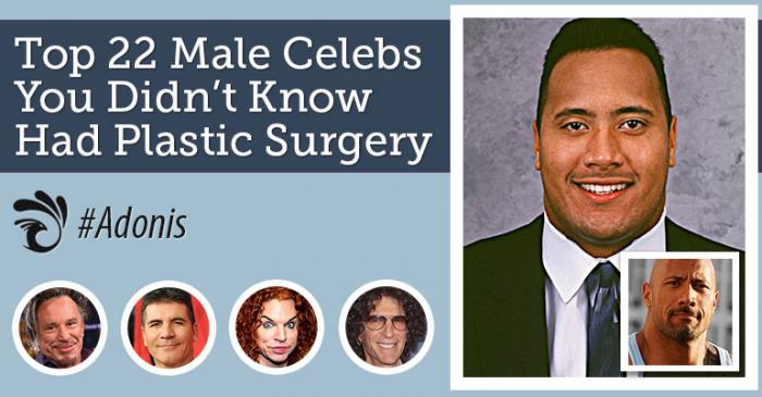 22 знаменитых мужчины, которые делали пластические операции