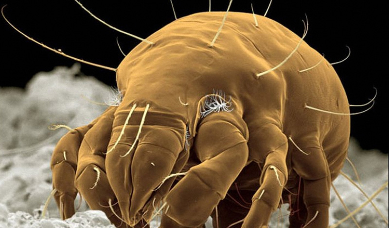 5 неприятных микроорганизмов, которые живут рядом с нами