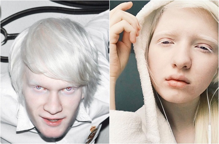 14 успешных моделей-альбиносов