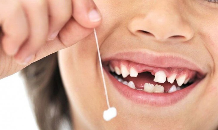 10 очень странных фактов о зубах