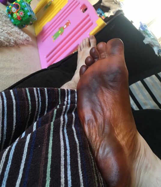 Жена использовала носок мужа для нанесения искусственного загара