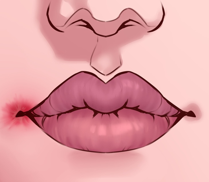 Что губы могут рассказать о проблемах со здоровьем