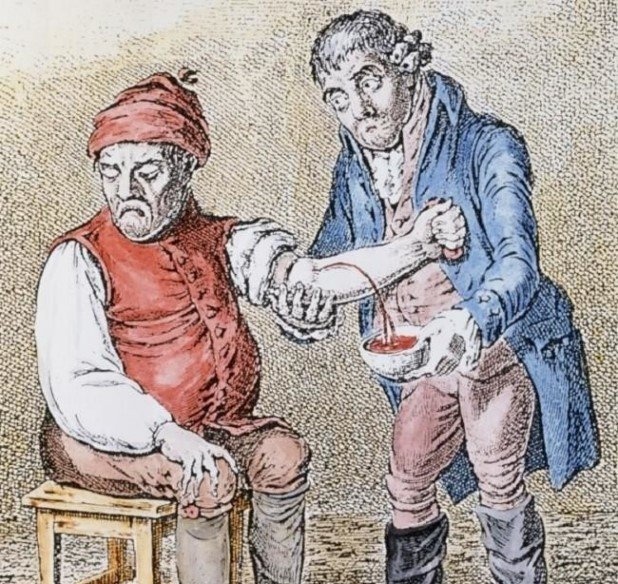 История кровопускания и его значение в медицине прошлого