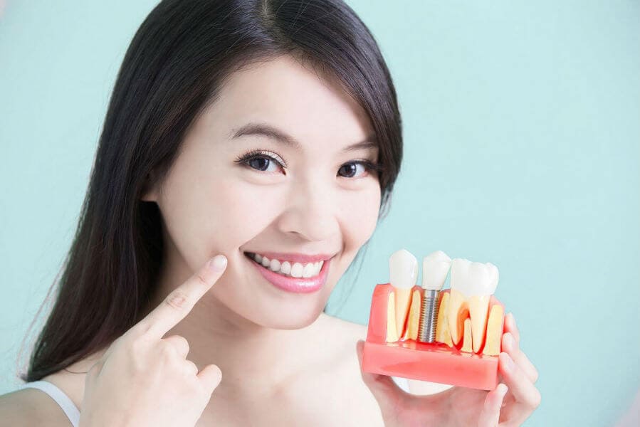 Основные особенности проведения имплантации зубов